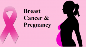 Pregnancy Associated Breast Cancer