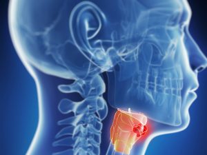 Head and Neck Cancer
